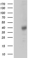 ZFP36 / Tristetraprolin Antibody - HEK293T cells were transfected with the pCMV6-ENTRY control (Left lane) or pCMV6-ENTRY ZFP36 (Right lane) cDNA for 48 hrs and lysed. Equivalent amounts of cell lysates (5 ug per lane) were separated by SDS-PAGE and immunoblotted with anti-ZFP36.