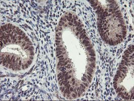 ZFP36 / Tristetraprolin Antibody - IHC of paraffin-embedded Human endometrium tissue using anti-ZFP36 mouse monoclonal antibody. (Heat-induced epitope retrieval by 10mM citric buffer, pH6.0, 100C for 10min).