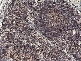 ZFP36 / Tristetraprolin Antibody - IHC of paraffin-embedded Human tonsil using anti-ZFP36 mouse monoclonal antibody. (Heat-induced epitope retrieval by 10mM citric buffer, pH6.0, 100C for 10min).