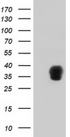 ZFP36 / Tristetraprolin Antibody - HEK293T cells were transfected with the pCMV6-ENTRY control (Left lane) or pCMV6-ENTRY ZFP36 (Right lane) cDNA for 48 hrs and lysed. Equivalent amounts of cell lysates (5 ug per lane) were separated by SDS-PAGE and immunoblotted with anti-ZFP36.