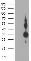 ZFP36 / Tristetraprolin Antibody - HEK293T cells were transfected with the pCMV6-ENTRY control (Left lane) or pCMV6-ENTRY ZFP36 (Right lane) cDNA for 48 hrs and lysed. Equivalent amounts of cell lysates (5 ug per lane) were separated by SDS-PAGE and immunoblotted with anti-ZFP36.