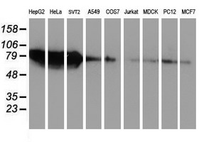 ZFP36 / Tristetraprolin Antibody - Western blot of extracts (35 ug) from 9 different cell lines by using anti-ZFP36 monoclonal antibody.