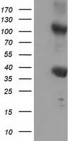 ZFP36 / Tristetraprolin Antibody - HEK293T cells were transfected with the pCMV6-ENTRY control. (Left lane) or pCMV6-ENTRY ZFP36. (Right lane) cDNA for 48 hrs and lysed