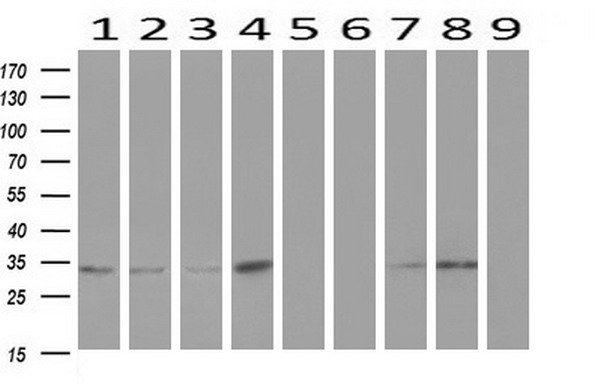 ZFP36 / Tristetraprolin Antibody - Western blot analysis of extracts. (10ug) from 9 Human tissue by using anti-ZFP36 monoclonal antibody at 1:200. (1: Testis; 2: Omentum; 3: Uterus; 4: Breast; 5: Brain; 6: Liver; 7: Ovary; 8: Thyroid gland; 9: colon).