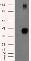 ZFP36 / Tristetraprolin Antibody - HEK293T cells were transfected with the pCMV6-ENTRY control (Left lane) or pCMV6-ENTRY ZFP36 (Right lane) cDNA for 48 hrs and lysed. Equivalent amounts of cell lysates (5 ug per lane) were separated by SDS-PAGE and immunoblotted with anti-ZFP36.