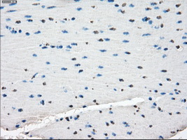 ZFP36 / Tristetraprolin Antibody - Immunohistochemical staining of paraffin-embedded colon tissue using anti-ZFP36 mouse monoclonal antibody. (Dilution 1:50).