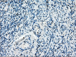 ZFP36 / Tristetraprolin Antibody - Immunohistochemical staining of paraffin-embedded Ovary tissue using anti-ZFP36 mouse monoclonal antibody. (Dilution 1:50).