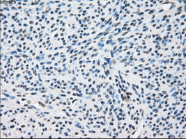 ZFP36 / Tristetraprolin Antibody - Immunohistochemical staining of paraffin-embedded endometrium tissue using anti-ZFP36 mouse monoclonal antibody. (Dilution 1:50).
