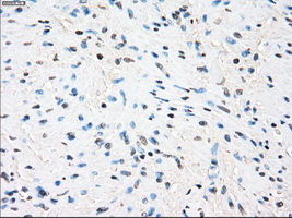 ZFP36 / Tristetraprolin Antibody - Immunohistochemical staining of paraffin-embedded prostate tissue using anti-ZFP36 mouse monoclonal antibody. (Dilution 1:50).