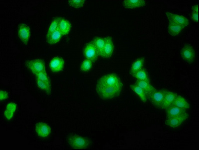 ZFP36 / Tristetraprolin Antibody - Immunofluorescence staining of HepG2 cells at a dilution of 1:100, counter-stained with DAPI. The cells were fixed in 4% formaldehyde, permeabilized using 0.2% Triton X-100 and blocked in 10% normal Goat Serum. The cells were then incubated with the antibody overnight at 4 °C.The secondary antibody was Alexa Fluor 488-congugated AffiniPure Goat Anti-Rabbit IgG (H+L) .