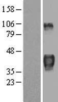 ZFP36 / Tristetraprolin Protein - Western validation with an anti-DDK antibody * L: Control HEK293 lysate R: Over-expression lysate