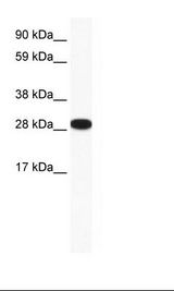 ZFP36L1 Antibody - Placenta Lysate.  This image was taken for the unconjugated form of this product. Other forms have not been tested.