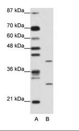 ZFP36L1 Antibody - A: Marker, B: Jurkat Cell Lysate.  This image was taken for the unconjugated form of this product. Other forms have not been tested.
