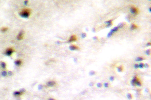 ZFP36L1 Antibody - IHC of TIS11B pAb in paraffin-embedded human brain tissue.