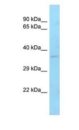 ZFP36L1 Antibody - ZFP36L1 antibody Western Blot of Mouse Liver. Antibody dilution: 1 ug/ml.  This image was taken for the unconjugated form of this product. Other forms have not been tested.