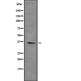 ZFP36L1 Antibody - Western blot analysis of TIS11B using Jurkat whole cells lysates