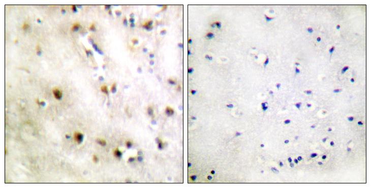 ZFP36L1 Antibody - Peptide - + Immunohistochemistry analysis of paraffin-embedded human brain tissue using TISB (Ab-92) antibody.