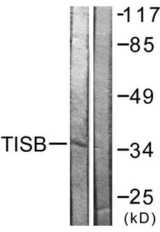 ZFP36L1 Antibody - Western blot analysis of extracts from Jurkat cells, using TISB (Ab-92) antibody.
