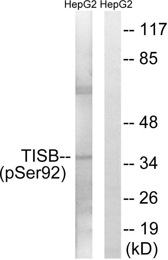 ZFP36L1 Antibody - Western blot analysis of lysates from HepG2 cells, using TISB (Phospho-Ser92) Antibody. The lane on the right is blocked with the phospho peptide.