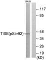 ZFP36L1 Antibody - Western blot analysis of extracts from RAW264.7 cells, using TISB (Phospho-Ser92) antibody.