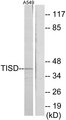 ZFP36L2 Antibody - Western blot analysis of lysates from A549 cells, using TISD Antibody. The lane on the right is blocked with the synthesized peptide.