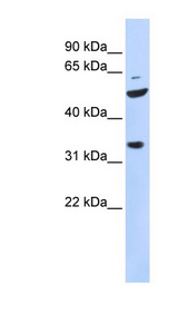 ZFP36L2 Antibody - ZFP36L2 / TIS11D antibody Western blot of 721_B cell lysate. This image was taken for the unconjugated form of this product. Other forms have not been tested.