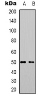 ZFP36L2 Antibody - Western blot analysis of ZFP36L2 expression in HepG2 (A); HL60 (B) whole cell lysates.