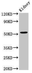 ZFP36L2 Antibody - Western Blot Positive WB detected in:Rat kidney tissue All Lanes:ZFP36L2 antibody at 2.6µg/ml Secondary Goat polyclonal to rabbit IgG at 1/50000 dilution Predicted band size: 52 KDa Observed band size: 52 KDa