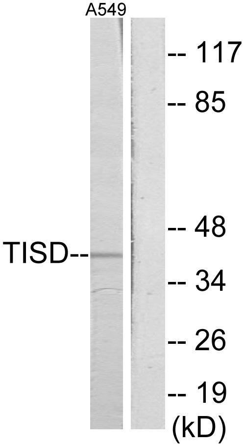 ZFP36L2 Antibody - Western blot analysis of extracts from A549 cells, using TISD antibody.