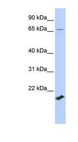 ZFP37 Antibody - ZFP37 antibody Western blot of 721_B cell lysate. This image was taken for the unconjugated form of this product. Other forms have not been tested.