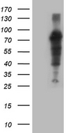 ZFP37 Antibody - HEK293T cells were transfected with the pCMV6-ENTRY control. (Left lane) or pCMV6-ENTRY ZFP37. (Right lane) cDNA for 48 hrs and lysed