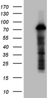 ZFP37 Antibody - HEK293T cells were transfected with the pCMV6-ENTRY control. (Left lane) or pCMV6-ENTRY ZFP37. (Right lane) cDNA for 48 hrs and lysed. Equivalent amounts of cell lysates. (5 ug per lane) were separated by SDS-PAGE and immunoblotted with anti-ZFP37. (1:2000)