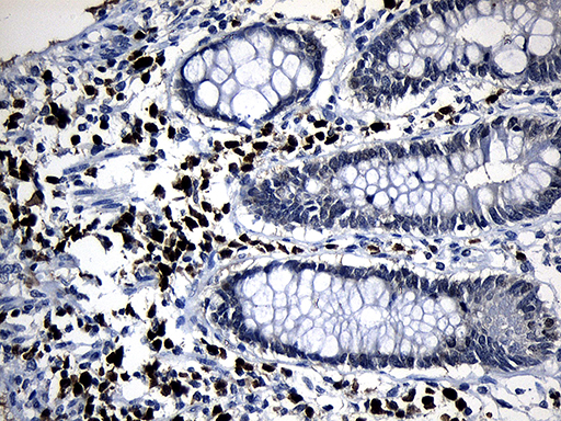 ZFP37 Antibody - Immunohistochemical staining of paraffin-embedded Human colon tissue within the normal limits using anti-ZFP37 mouse monoclonal antibody. (Heat-induced epitope retrieval by 1mM EDTA in 10mM Tris buffer. (pH8.5) at 120°C for 3 min. (1:150)