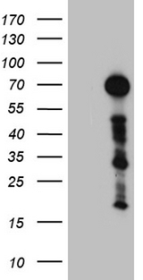 ZFP37 Antibody - HEK293T cells were transfected with the pCMV6-ENTRY control. (Left lane) or pCMV6-ENTRY ZFP37. (Right lane) cDNA for 48 hrs and lysed