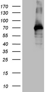 ZFP37 Antibody - HEK293T cells were transfected with the pCMV6-ENTRY control. (Left lane) or pCMV6-ENTRY ZFP37. (Right lane) cDNA for 48 hrs and lysed