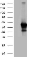 ZFP42 / REX-1 Antibody - HEK293T cells were transfected with the pCMV6-ENTRY control. (Left lane) or pCMV6-ENTRY ZFP42. (Right lane) cDNA for 48 hrs and lysed. Equivalent amounts of cell lysates. (5 ug per lane) were separated by SDS-PAGE and immunoblotted with anti-ZFP42. (1:2000)