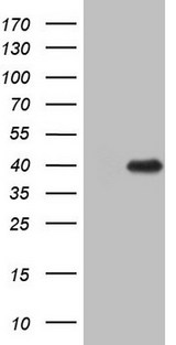 ZFP42 / REX-1 Antibody - HEK293T cells were transfected with the pCMV6-ENTRY control. (Left lane) or pCMV6-ENTRY ZFP42. (Right lane) cDNA for 48 hrs and lysed. Equivalent amounts of cell lysates. (5 ug per lane) were separated by SDS-PAGE and immunoblotted with anti-ZFP42.