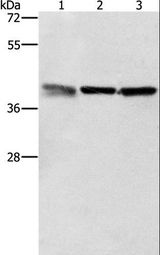 ZFP42 / REX-1 Antibody - Western blot analysis of A549, K562 and PC3 cell, using ZFP42 Polyclonal Antibody at dilution of 1:500.