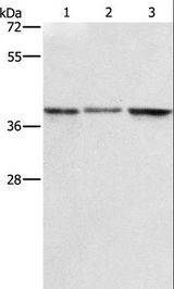 ZFP42 / REX-1 Antibody - Western blot analysis of A549, K562 and PC3 cell, using ZFP42 Polyclonal Antibody at dilution of 1:500.