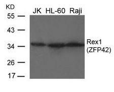 ZFP42 / REX-1 Antibody - Western blot of extracts from JK, HL-60 and Raji cells using Rex1(ZFP42) Antibody