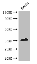 ZFP42 / REX-1 Antibody - Positive WB detected in:Mouse brain tissue;All lanes: ZFP42 antibody at 3ug/ml;Secondary;Goat polyclonal to rabbit IgG at 1/50000 dilution;Predicted band size: 35 kDa;Observed band size: 35 kDa;
