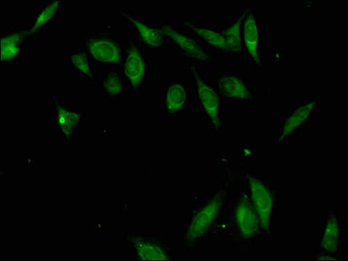 ZFP42 / REX-1 Antibody - Immunofluorescent analysis of Hela cells using ZFP42 Antibody at a dilution of 1:100 and Alexa Fluor 488-congugated AffiniPure Goat Anti-Rabbit IgG(H+L)