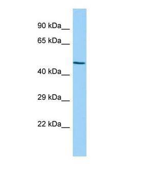 Zfp566 Antibody - Western blot of Zfp566 Antibody - middle region in Rat Spleen cells lysate.  This image was taken for the unconjugated form of this product. Other forms have not been tested.