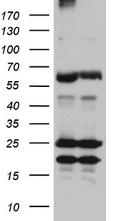 ZFP57 Antibody - HEK293T cells were transfected with the pCMV6-ENTRY control. (Left lane) or pCMV6-ENTRY ZFP57. (Right lane) cDNA for 48 hrs and lysed. Equivalent amounts of cell lysates. (5 ug per lane) were separated by SDS-PAGE and immunoblotted with anti-ZFP57. (1:2000)