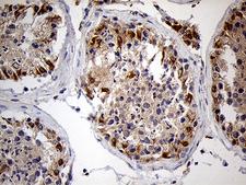 ZFP57 Antibody - Immunohistochemical staining of paraffin-embedded Human testicle tissue within the normal limits using anti-ZFP57 mouse monoclonal antibody. (Heat-induced epitope retrieval by 1mM EDTA in 10mM Tris buffer. (pH8.5) at 120°C for 3 min. (1:2000)