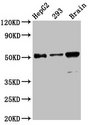 ZFP57 Antibody - Western Blot Positive WB detected in: HepG2 whole cell lysate, 293 whole cell lysate, Mouse brain tissue All Lanes: ZFP57 antibody at 13.6µg/ml Secondary Goat polyclonal to rabbit IgG at 1/50000 dilution Predicted band size: 52, 60, 62 KDa Observed band size: 52 KDa