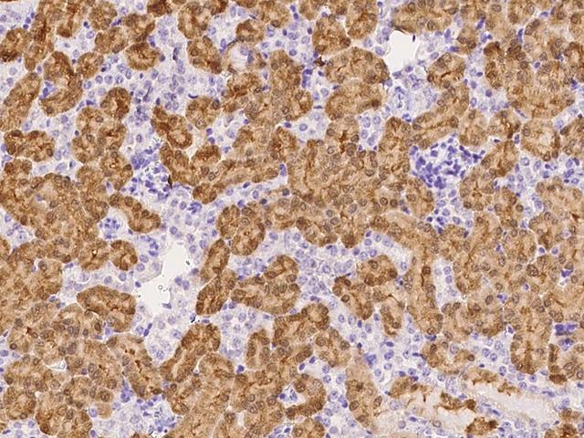 ZFP57 Antibody - Immunochemical staining of mouse ZFP57 in mouse kidney with rabbit polyclonal antibody at 1:1000 dilution, formalin-fixed paraffin embedded sections.