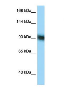 ZFP62 Antibody - ZFP62 antibody Western blot of 8226 Cell lysate. Antibody concentration 1 ug/ml.  This image was taken for the unconjugated form of this product. Other forms have not been tested.