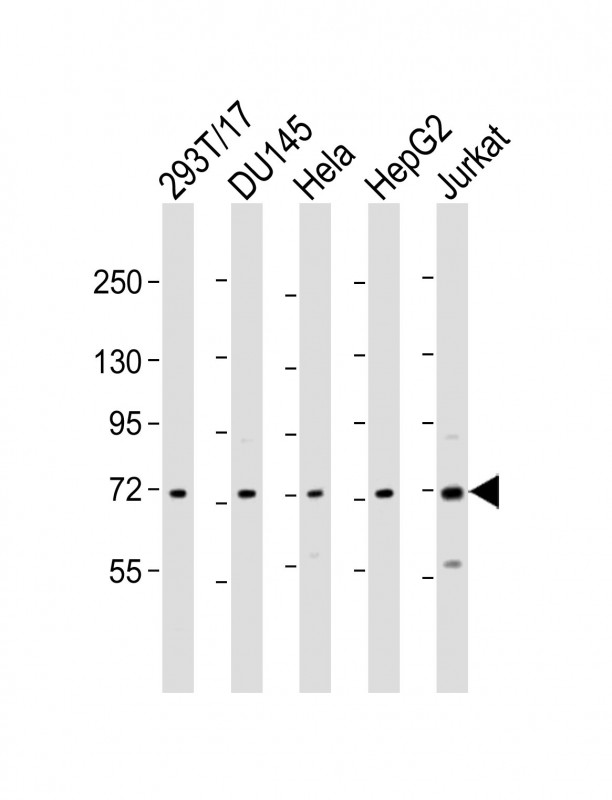ZFP64 Antibody - All lanes: Anti-ZFP64 Antibody (C-Term) at 1:2000 dilution. Lane 1: 293T/17 whole cell lysate. Lane 2: DU145 whole cell lysate. Lane 3: HeLa whole cell lysate. Lane 4: HepG2 whole cell lysate. Lane 5: Jurkat whole cell lysate Lysates/proteins at 20 ug per lane. Secondary Goat Anti-Rabbit IgG, (H+L), Peroxidase conjugated at 1:10000 dilution. Predicted band size: 75 kDa. Blocking/Dilution buffer: 5% NFDM/TBST.
