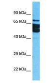 ZFP64 Antibody - ZFP64 antibody Western Blot of HepG2. Antibody dilution: 1 ug/ml.  This image was taken for the unconjugated form of this product. Other forms have not been tested.